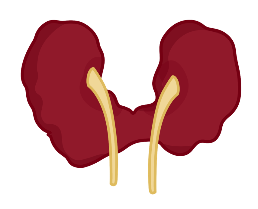 Horseshoe kidney