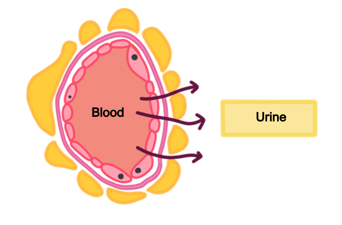 Nephrotic syndrome