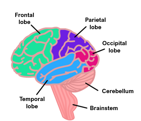 Brain tumours glioblastoma multiforme