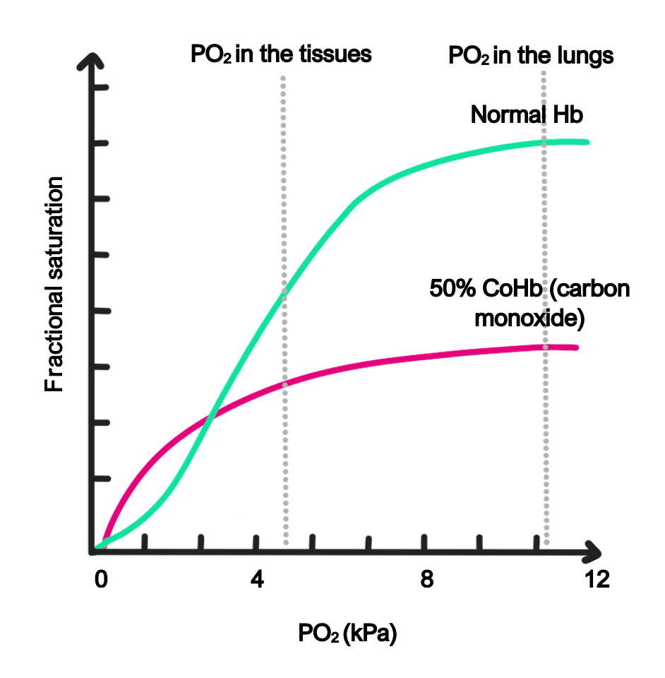 CO poisoning Carbon monoxide poisoning