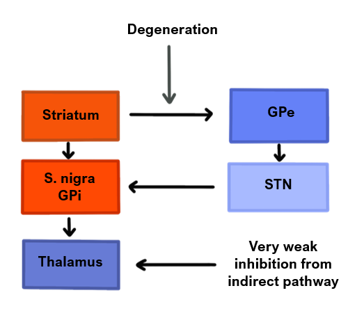 Huntington's disease Huntington's pathophysiology