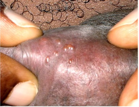Picture 1