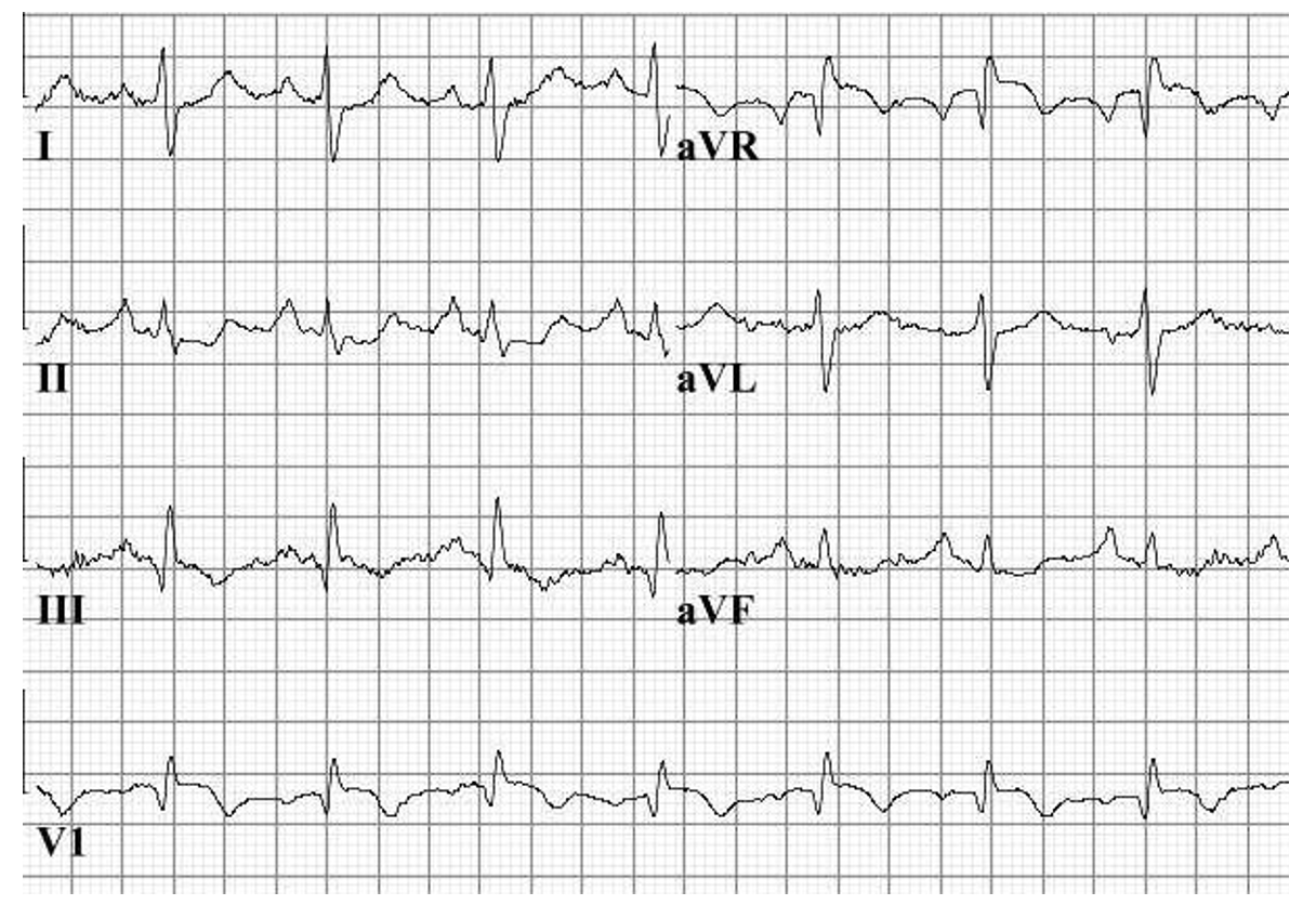 Screenshot 2021-08-20 at 13.37.15 ECG