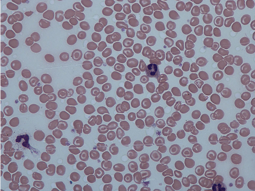target cell target cell