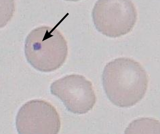 Howell-Jolly bodies Howell-Jolly bodies
