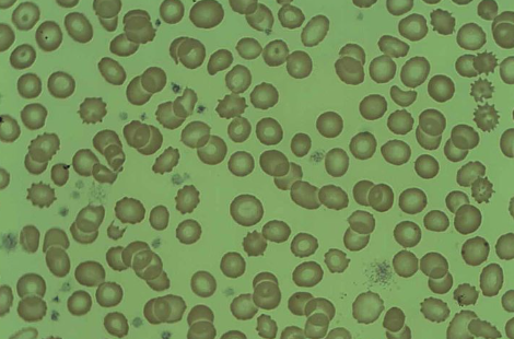 Burr cells Burr cells