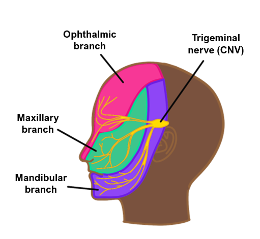Trigeminal neuralgia Bell's palsy