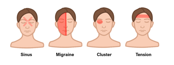 headaches