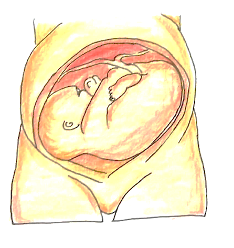Picture 1