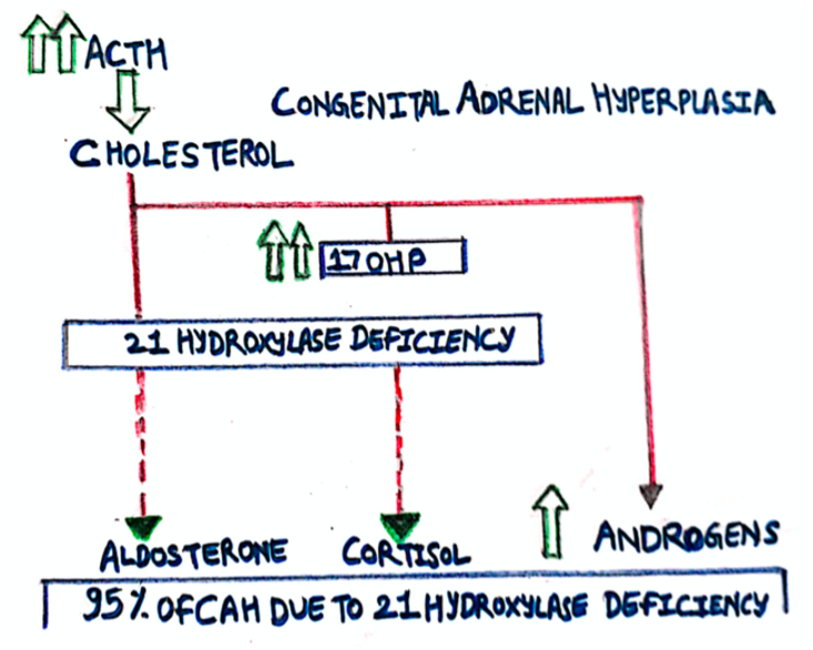 Picture 1 congenital adrenal hyperplasia