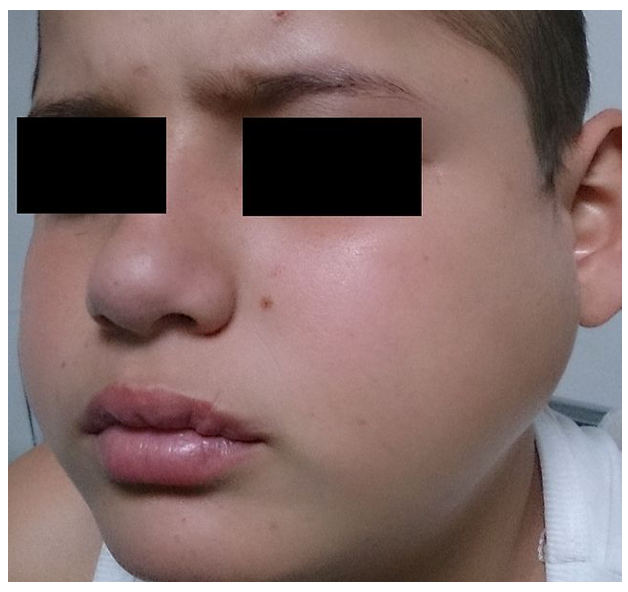 Screenshot 2021-09-07 at 19.39.52 mumps