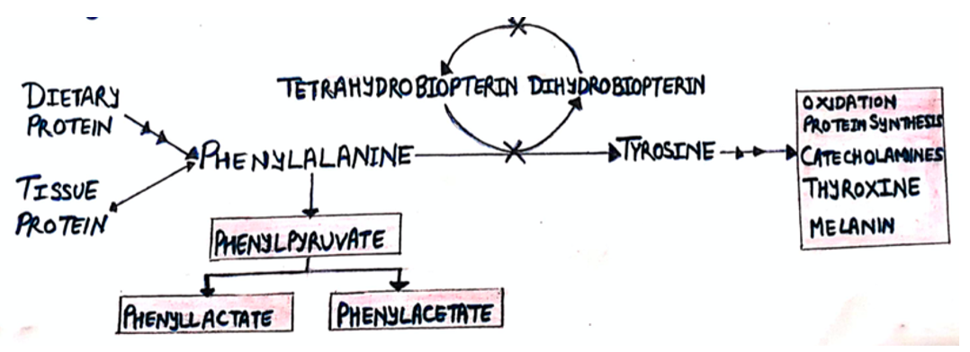 Screenshot 2021-09-07 at 21.02.59 phenylketonuria
