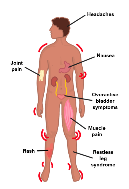fibromyalgia