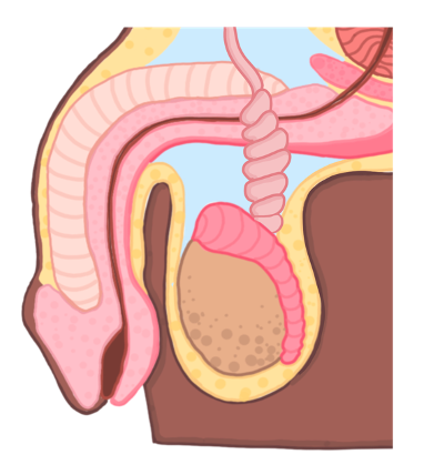 Testicular torsion