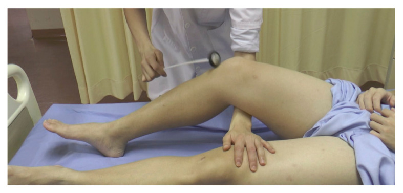 Knee Reflex