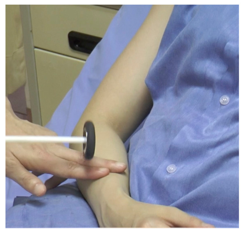 supinator reflex