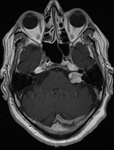 head MRI head MRI
