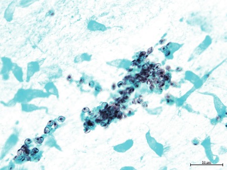 sputum sample histology sputum sample histology