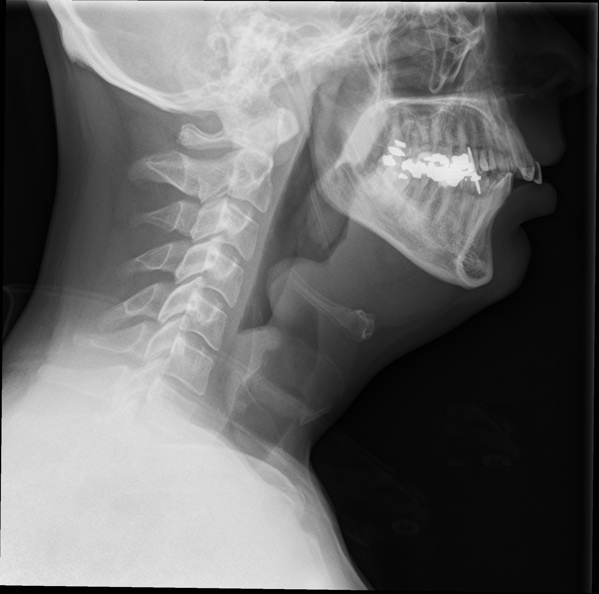 Child X-ray Child X-ray