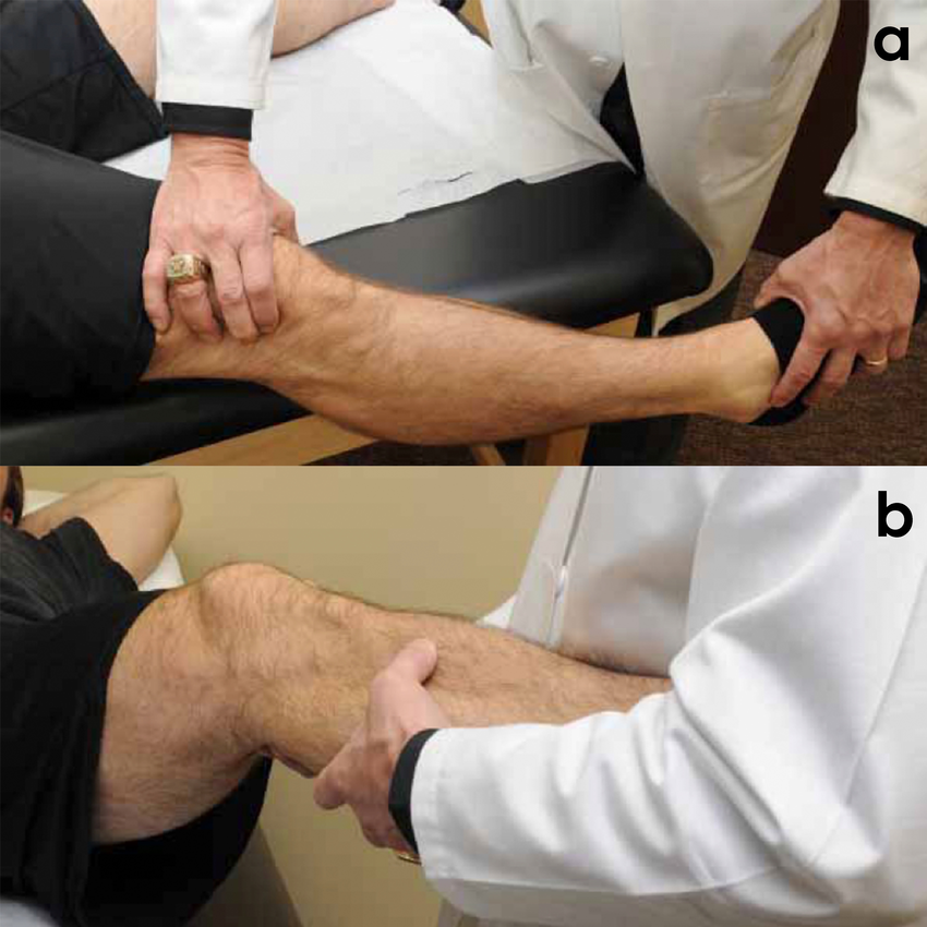 Demonstration-of-the-varus-stress-test-a-performed-at-0-degrees-of-knee-flexion-and-b