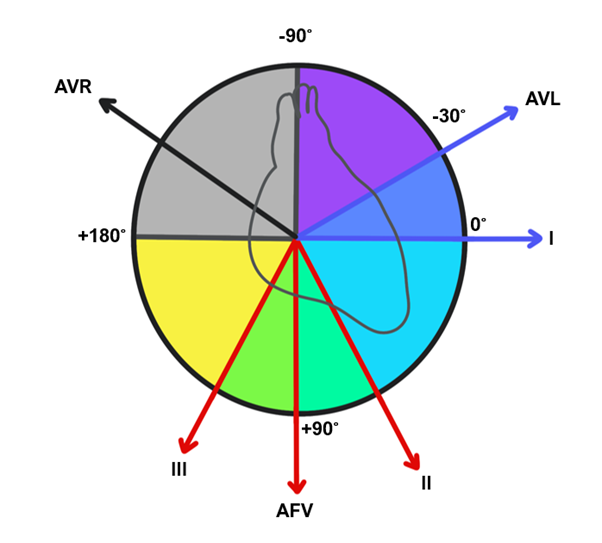 AXIS 2 degree method ECG