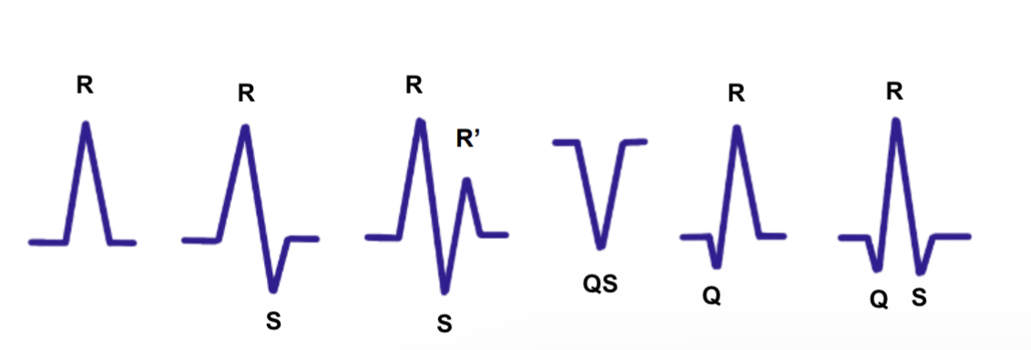 IMG-0683 QRS complex