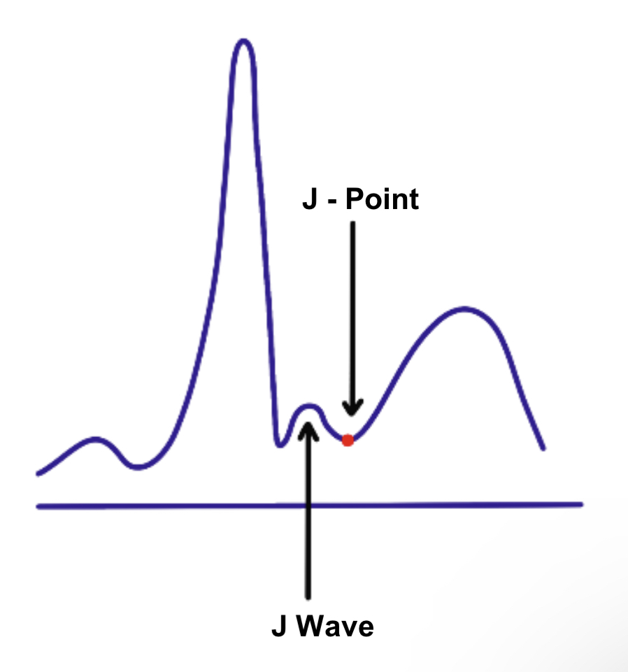 IMG-0685 J - wave