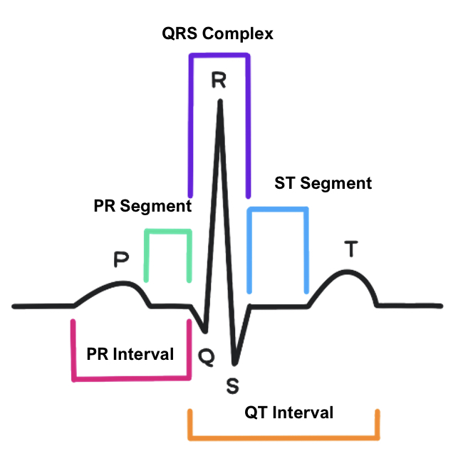 IMG-0692 ECG