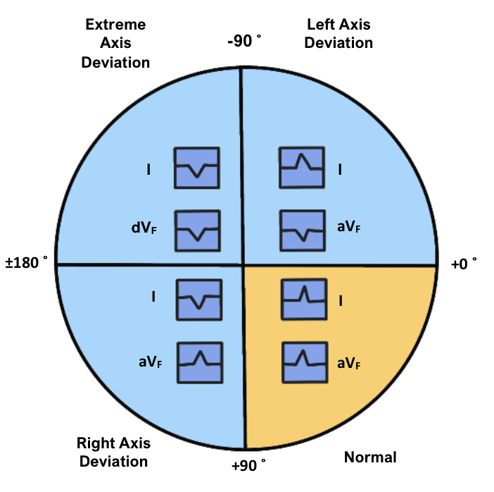 IMG-0693 ECG Axis