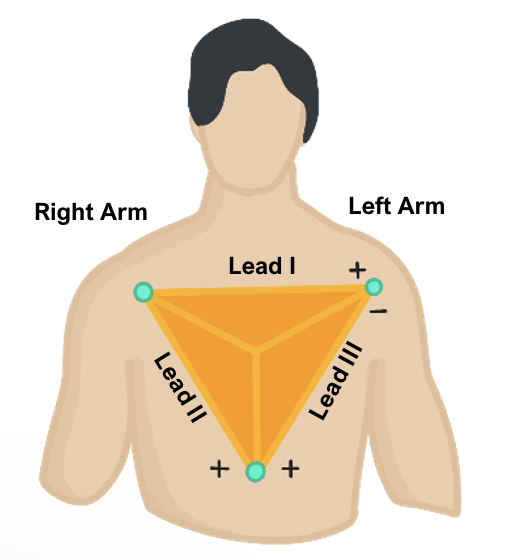 IMG-0694 Limb Leads ECG