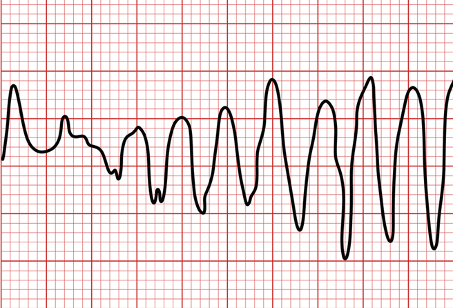 POLYMORPHIC VT