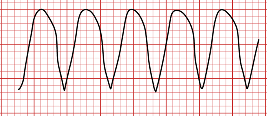 monomorphic vt