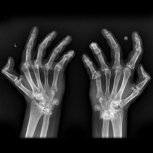 ra hand