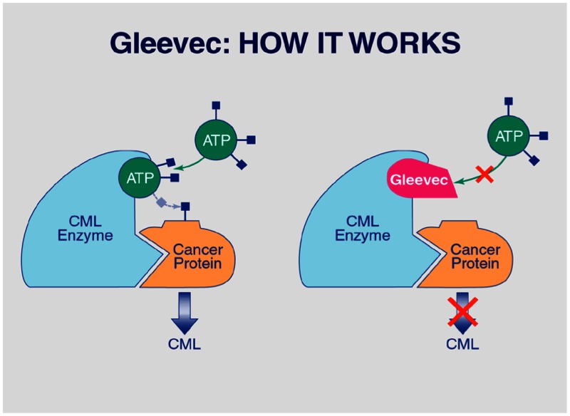 gleevec