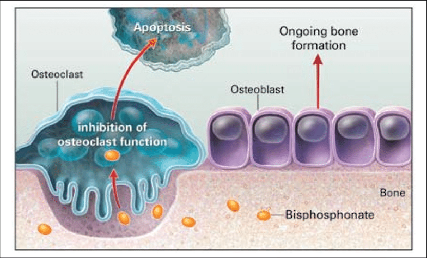 Proposed-mechanism-of-action-of-bisphosphonates-Reprinted-with-permission-from-Solomon